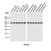 GPI Antibody Multi-Species Liver and Kidney WB. Western blot analysis of liver and kidney tissue lysates from human, mouse, rat, hamster, guinea pig, and rabbit using Glucose 6-phosphate isomerase Antibody clone GPI/2439. Distinct bands are detected at approximately 55-60 kDa across multiple mammalian liver and kidney samples, consistent with the predicted molecular weight of Glucose-6-phosphate isomerase / GPI, a highly conserved glycolytic enzyme involved in glucose metabolism and energy production. The broad cross-species reactivity pattern is consistent with the ubiquitous metabolic expression of GPI in energetically active tissues.