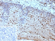 IHC staining of FFPE human tonsil tissue with HLA-E antibody (clone HLAE/9468). Inset: PBS used in place of primary Ab (secondary Ab negative control). HIER: boil tissue sections in pH 9 10mM Tris with 1mM EDTA for 20 min and allow to cool before testing.