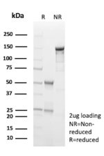 Purified BIRC5 Antibody BIRC5/9073 SDS-PAGE. SDS-PAGE analysis of 2 ug purified, BSA-free BIRC5 Antibody clone BIRC5/9073 under reduced (R) and non-reduced (NR) conditions demonstrates the integrity of the mouse monoclonal antibody preparation. Under reducing conditions, the expected immunoglobulin heavy-chain band is visible near 50 kDa and the light-chain band near 25 kDa, while the intact non-reduced antibody migrates predominantly near approximately 150 kDa.