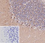 Amyloid A4 Antibody APP/9971R in Human Brain Tissue IHC. Immunohistochemistry staining of FFPE human brain tissue with Amyloid A4 Antibody clone APP/9971R demonstrates heterogeneous brown staining within the brain parenchyma, including cytoplasmic and neuropil-associated signal. HIER was performed by boiling sections in 10 mM Tris with 1 mM EDTA, pH 9, for 20 min followed by cooling before testing. The PBS negative-control inset shows little to no corresponding brown staining, supporting the specificity of the observed A4 Antibody signal under the tested conditions.