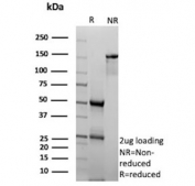 SDS-PAGE analysis of purified, BSA-free Inhibin alpha chain/INHA antibody (clone INHA/9354) as confirmation of integrity and purity.