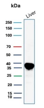 Arginase 1 Antibody for WB (clone ARG1/9446). Western blot analysis of human liver lysate. Western blot detection using the mouse monoclonal Arginase 1 Antibody for WB (clone ARG1/9446) shows a strong immunoreactive band in human liver tissue lysate. Lane 1: human liver lysate. A band is detected at approximately 35 kDa, consistent with the predicted molecular weight of Arginase-1 (ARG1), a cytosolic urea cycle enzyme highly enriched in hepatocytes and responsible for the conversion of L-arginine to urea and ornithine in hepatic nitrogen metabolism.