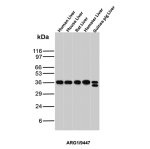 Liver Arginase Antibody by WB in Multiple Species. Western blot analysis of human, mouse, rat, hamster, and guinea pig liver tissue lysates using Liver Arginase Antibody (ARG1/9447). Lane 1: human liver; lane 2: mouse liver; lane 3: rat liver; lane 4: hamster liver; lane 5: guinea pig liver. A prominent immunoreactive band is detected at approximately 35-38 kDa in all five species, consistent with the predicted molecular weight of ARG1 (~35 kDa). The Arginase-1 ARG1 Antibody demonstrates strong cross-species reactivity, with comparable band intensities across the liver samples. An additional band near 32 kDa is visible in guinea pig liver lysate.