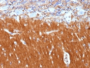 IHC staining of FFPE human brain tissue with Neural cell adhesion molecule L1 antibody (clone L1CAM/13053R). HIER: boil tissue sections in pH 9 10mM Tris with 1mM EDTA for 20 min and allow to cool before testing.