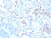 Mannose Receptor Antibody Human Lung IHC. Immunohistochemical staining of FFPE human lung tissue using Mannose Receptor antibody (clone MRC1/9457) demonstrates distinct cytoplasmic and membranous HRP-DAB brown staining within scattered immune cell populations distributed throughout the pulmonary tissue. The staining pattern is consistent with expression of the Mannose Receptor (MRC1/CD206), a C-type lectin receptor involved in carbohydrate recognition, receptor-mediated endocytosis, antigen processing, and macrophage-mediated immune regulation. Positive immunoreactivity is observed in cells morphologically consistent with alveolar macrophages and other antigen-presenting cell populations that contribute to pulmonary immune surveillance and maintenance of respiratory tissue homeostasis. Inset: PBS was used in place of the primary antibody as a negative control. HIER: boil tissue sections in pH 9, 10mM Tris with 1mM EDTA for 20 min and allow to cool before testing.