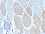 Immunohistochemistry analysis of Myosin 7 / MYH7 antibody (clone MYH7/13050R) in human skeletal muscle tissue. FFPE human skeletal muscle section shows cytoplasmic brown chromogenic staining in a subset of muscle fibers consistent with type I slow-twitch fiber expression of MYH7, while adjacent fibers show weaker or minimal staining and nuclei appear blue. The inset shows PBS used in place of primary antibody as a negative control with no specific staining observed. Heat-induced epitope retrieval was performed by boiling tissue sections in pH 9 10 mM Tris with 1 mM EDTA for 20 minutes followed by cooling prior to staining.