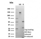 SDS-PAGE analysis of purified, BSA-free ATM antibody (clone ATM/9472) as confirmation of integrity and purity.