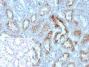 IHC analysis of Nucleoside diphosphate kinase B / NME2 antibody in human kidney tissue. Formalin-fixed, paraffin-embedded human kidney shows cytoplasmic HRP-DAB brown chromogenic staining in renal tubular epithelial cells, with minimal staining in glomerular compartments. Clone NME2/12061 demonstrates specific signal following heat-induced epitope retrieval in pH 9 10mM Tris with 1mM EDTA for 20 min. The inset negative control using PBS instead of primary antibody shows no specific staining.