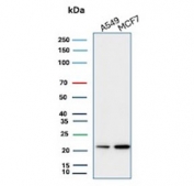 Western blot testing of human A549 and MCF7 cell lysate with recombinant Bax antibody (clone rBAX/962). Predicted molecular weight ~21 kDa.