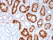 ACE2 Antibody Clone ACE2/7202 in human kidney tissue. Immunohistochemistry staining of FFPE human kidney demonstrates strong membranous and cytoplasmic staining in renal tubular epithelial cells, consistent with the known epithelial localization of Angiotensin-converting enzyme 2 / ACE2 in kidney tubules. The inset shows PBS used in place of primary antibody as a secondary-only negative control. Heat-induced epitope retrieval was performed by boiling tissue sections in pH 9 Tris buffer with 1 mM EDTA for 20 min before staining. Brown chromogenic signal marks ACE2-positive tubular epithelial cells while surrounding stromal elements remain largely negative.