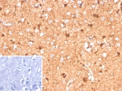 Immunohistochemistry analysis of S100B / S100 calcium-binding protein B antibody (clone S100B/12587R) in human brain tissue. FFPE human brain demonstrates diffuse cytoplasmic and nuclear HRP-DAB brown staining in glial cells, consistent with S100B expression. Staining highlights astrocyte-like cells with branching morphology distributed throughout the parenchyma, while neuronal cell bodies show comparatively weaker signal. Nuclei are counterstained blue. The inset image represents a secondary antibody negative control in which PBS was used in place of the primary antibody and shows absence of specific staining. Heat induced epitope retrieval was performed by boiling tissue sections in 10 mM Tris with 1 mM EDTA, pH 9.0, for 20 minutes followed by cooling prior to immunostaining.