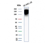 Western blot analysis of CEACAM1 antibody in human SK-MEL-28 cell lysate. A strong high molecular weight band and broad signal are observed well above the predicted molecular weight of 58 kDa. In some experimental settings, a lighter band may be detected near the predicted molecular weight, representing less glycosylated forms of CEACAM1. The predicted molecular weight of CEACAM1, also known as BGP-1, is approximately 58 kDa based on amino acid sequence; however, CEACAM1 is a heavily N-glycosylated type I membrane glycoprotein. Extensive N-linked glycosylation, heterogeneous glycoform distribution, and potential dimerization can result in markedly slower SDS-PAGE migration and apparent molecular weights substantially higher than the sequence-predicted size. The prominent high molecular weight signal observed here is therefore consistent with glycosylated CEACAM1 species in melanoma-derived cells.