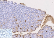 Immunohistochemistry analysis of CEACAM1 antibody in human colon tissue. FFPE human colon sections show membranous and apical HRP-DAB brown staining in glandular epithelial cells, consistent with CEACAM1 expression at the luminal surface. Stromal elements show minimal staining. The inset negative control, in which PBS was used in place of primary antibody, shows no specific brown chromogenic signal. Heat induced epitope retrieval was performed by boiling tissue sections in pH 9 10 mM Tris with 1 mM EDTA for 20 minutes followed by cooling prior to staining.