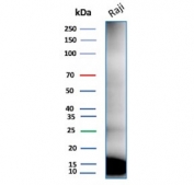 Western blot testing of human Raji tissue lysate with Ubiquitin antibody (clone rUBB/9476).