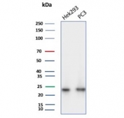 Western blot testing of human HEK293 and PC-3 cell lysate with PGP9.5 antibody (clone UCHL1/8153). Predicted molecular weight ~25 kDa.