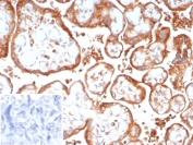 IHC staining of FFPE human placenta tissue with VEGFA antibody (clone VEGF/9366). Inset: PBS used in place of primary Ab (secondary Ab negative control). HIER: boil tissue sections in pH 9 10mM Tris with 1mM EDTA for 20 min and allow to cool before testing.