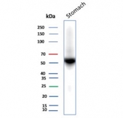 Western blot testing of human stomach tissue lysate with recombinant CA9 antibody (clone rCA9/9937). Predicted molecular weight: 50-55 kDa but may be observed at higher molecular weights due to glycosylation.
