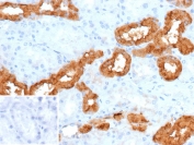 Immunohistochemistry analysis of CALB1 / Calbindin antibody (clone rKR6) in human tonsil tissue. Formalin-fixed, paraffin-embedded human tonsil shows cytoplasmic HRP-DAB brown staining in subsets of lymphoid and stromal cells, consistent with Calbindin expression, while surrounding cells remain largely negative. Nuclear counterstain highlights tissue architecture. The inset shows PBS used in place of primary antibody as a negative control, demonstrating absence of specific staining. Heat-induced epitope retrieval was performed by boiling sections in pH 9 10 mM Tris with 1 mM EDTA for 20 minutes followed by cooling prior to staining.