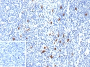 Immunohistochemistry analysis of CD83 molecule Antibody in human tonsil tissue. FFPE human tonsil demonstrates distinct HRP-DAB brown staining in scattered dendritic-shaped cells within the lymphoid tissue, consistent with CD83-positive mature dendritic cells, while the majority of surrounding lymphocytes remain negative. The inset image, using PBS in place of primary antibody as a secondary-only negative control, shows no specific staining. Antigen retrieval was performed by heating tissue sections in 10mM Tris with 1mM EDTA, pH 9.0, at 95oC for 45 minutes followed by cooling at room temperature for 20 minutes prior to incubation with CD83 antibody (clone r1H4b).