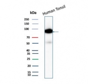 CD19 Antibody Human Tonsil WB. Western blot analysis of human tonsil tissue lysate using recombinant CD19 Antibody / B Cell Marker Antibody (clone CD19/4260R). A specific band is detected between approximately 60â100 kDa, consistent with the expected molecular weight range of glycosylated CD19 protein. Detection in human lymphoid tissue supports CD19 expression as a B cell surface marker. These results support the use of CD19 Antibody / B Cell Marker Antibody, a Protein Microarray Validated recombinant monoclonal antibody, for studying B lymphocyte biology, immune cell signaling and hematopoietic research pathways.