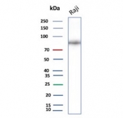CD19 Antibody Raji Cell WB. Western blot analysis of human Raji cell lysate using recombinant CD19 Antibody / B Cell Marker Antibody (clone CD19/4260R). A specific band is detected between approximately 60â100 kDa, consistent with the expected molecular weight range of glycosylated CD19 protein. Detection in Raji B lymphocyte cells demonstrates antibody performance in a relevant CD19-positive model system. These results support the use of CD19 Antibody / B Cell Marker Antibody, a Protein Microarray Validated recombinant monoclonal antibody, for studying B cell markers, lymphocyte signaling and immune cell research.