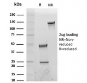 SDS-PAGE analysis of purified, BSA-free recombinant CD19 antibody (clone CD19/4260R) as confirmation of integrity and purity.