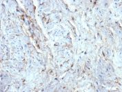 IHC staining of FFPE human uterus tissue with recombinant CD34 antibody (clone rICO-115). HIER: boil tissue sections in pH 9 10mM Tris with 1mM EDTA for 20 min and allow to cool before testing.