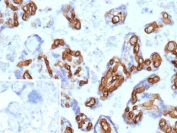 IHC staining of FFPE human placental tissue with recombinant CD34 antibody (clone rICO-115). Inset: PBS used in place of primary Ab (secondary Ab negative control). HIER: boil tissue sections in pH 9 10mM Tris with 1mM EDTA for 20 min and allow to cool before testing.