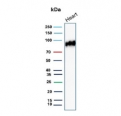 Platelet Glycoprotein 4 Antibody Human Heart WB. Western blot analysis of human heart tissue lysate demonstrates CD36 expression using Platelet Glycoprotein 4 Antibody clone CD36/7216. Platelet Glycoprotein 4, also known as CD36 and Lipid Uptake Protein, is a multifunctional scavenger receptor that mediates long chain fatty acid uptake and contributes to cardiac energy metabolism. A prominent band is detected at approximately 90 kDa, consistent with the heavily glycosylated form of CD36. The apparent molecular weight of CD36 is known to vary from approximately 53 to 88 kDa depending on the degree of glycosylation. These results support the utility of Platelet Glycoprotein 4 Antibody for studies of lipid transport, cardiovascular biology, metabolic regulation, and scavenger receptor function.