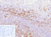 ADP-ribosyl cyclase 1 Antibody human tonsil tissue IHC. Immunohistochemistry analysis of CD38 expression in FFPE human tonsil tissue using ADP-ribosyl cyclase 1 antibody clone CD38/9332. Strong membranous and cytoplasmic HRP-DAB brown staining highlights plasma cells and activated lymphocytes within interfollicular regions and around germinal centers, consistent with expression of this NAD-metabolizing ectoenzyme in immune cell populations. The staining pattern demonstrates dense immune cell distribution with clear contrast against predominantly negative background lymphocytes. Inset: PBS was used in place of the primary antibody as a secondary antibody negative control. HIER was performed by boiling tissue sections in pH 9 10 mM Tris with 1 mM EDTA for 20 minutes followed by cooling prior to antibody incubation.