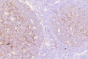 ADP-ribosyl cyclase 1 Antibody human tonsil tissue IHC. Immunohistochemistry analysis of CD38 expression in FFPE human tonsil tissue using ADP-ribosyl cyclase 1 antibody clone CD38/9332. Strong membranous and cytoplasmic HRP-DAB brown staining highlights plasma cells and activated lymphocytes distributed throughout interfollicular regions and germinal center-associated areas, consistent with expression of this NAD-metabolizing enzyme in immune cell populations. The staining pattern demonstrates widespread immune cell localization with clear contrast against predominantly negative background lymphocytes. Inset: PBS was used in place of the primary antibody as a secondary antibody negative control. HIER was performed by boiling tissue sections in pH 9 10 mM Tris with 1 mM EDTA for 20 minutes followed by cooling prior to antibody incubation.
