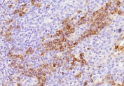 ADPRC1 Antibody human tonsil tissue IHC. Immunohistochemistry analysis of CD38 expression in FFPE human tonsil tissue using ADPRC1 antibody clone CD38/9333. Strong membranous and cytoplasmic HRP-DAB brown staining highlights plasma cells and activated lymphocytes within interfollicular regions and around germinal centers, consistent with ADPRC1 gene expression in immune cell populations. The staining pattern demonstrates variable intensity among positive cells, reflecting differences in expression level across immune cell subsets, with clear contrast against predominantly negative background lymphocytes. HIER was performed by boiling tissue sections in pH 9 10 mM Tris with 1 mM EDTA for 20 minutes followed by cooling prior to antibody incubation.