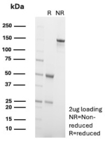 SDS-PAGE Analysis of Purified CDH3 / Cadherin 3 Antibody (clone r56C1). Confirmation of Purity and Integrity of Antibody.