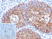 Immunohistochemical analysis of CDKN2A in FFPE human cervix tissue using CDKN2A antibody recombinant mouse mAb (clone rCDKN2A/13303). Strong nuclear and cytoplasmic staining is observed in epithelial cells within the cervical tissue, consistent with Cyclin-dependent kinase inhibitor 2A localization. Inset shows a negative control section processed in parallel using PBS in place of the primary antibody, demonstrating minimal background staining.