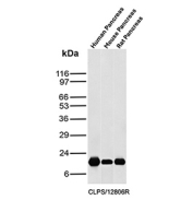 CLPS Antibody Comparative Pancreas WB. Western blot analysis of human pancreas lysate, mouse pancreas lysate, and rat pancreas lysate using CLPS antibody. The recombinant rabbit monoclonal antibody clone CLPS/12806R detects a distinct band at approximately 12 kDa, consistent with the predicted molecular weight of Colipase / CLPS. Comparable signal intensity across species supports conserved expression in pancreatic tissue, while minimal background staining reinforces specificity for this pancreatic digestive enzyme marker.