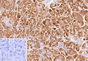 CLPS Antibody Human Pancreas Tissue IHC. Immunohistochemistry analysis of FFPE human pancreas tissue using CLPS antibody. The recombinant rabbit monoclonal antibody clone CLPS/12806R shows strong HRP-DAB brown cytoplasmic staining in pancreatic acinar cells, with a granular distribution consistent with Colipase / CLPS expression as a pancreatic digestive enzyme marker. Surrounding stromal elements display minimal background, and a PBS-only control confirms low non-specific staining. HIER: boil tissue sections in 10 mM Tris with 1 mM EDTA, pH 9.0, for 45 min at 95oC followed by cooling at RT for 20 min.