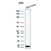 CLPS Antibody Human Pancreas WB. Western blot analysis of human pancreas lysate using CLPS antibody. The recombinant rabbit monoclonal antibody clone CLPS/12806R detects a band at approximately 12 kDa, consistent with the predicted molecular weight of Colipase / CLPS. Strong signal in pancreatic tissue aligns with its role as a digestive enzyme cofactor produced by acinar cells, while low background supports specific detection of this pancreatic enzyme marker.