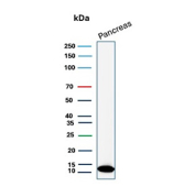 Western blot analysis of human pancreas tissue lysate using CLPS/Colipase antibody (clone CLPS/12806R). Predicted molecular weight ~12 kDa.