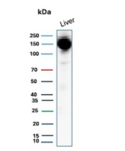 Western blot analysis of human liver tissue lysates using Hepatocyte specific antigen/CPS1 antibody (clone CPS1/13326R). Predicted molecular weight ~165 kDa.