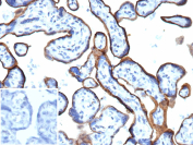 ENG Antibody FFPE Placenta IHC. Immunohistochemistry analysis of Endoglin (CD105) expression. Recombinant ENG/Endoglin antibody (clone r4G11) staining was performed on formalin-fixed, paraffin-embedded human placenta tissue, showing strong DAB-positive membranous staining outlining vascular endothelial cells within placental villi, with hematoxylin counterstaining. The inset shows a negative control processed in parallel using PBS in place of the primary antibody, demonstrating minimal background signal with secondary antibody only. Staining of formalin-fixed tissues requires heating tissue sections in 10mM Tris with 1mM EDTA, pH 9.0, for 45 min at 95oC followed by cooling at RT for 20 minutes.