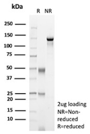 SDS-PAGE Analysis of purified recombinant ENG/Endoglin antibody (clone r4G11). Confirmation of Purity and Integrity of Antibody.