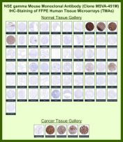 Gamma-enolase Antibody for IHC Tissue Microarray (TMA) Multi-Tissue Expression. Immunohistochemistry analysis of Gamma-enolase (ENO2) expression in FFPE human tissue microarray (TMA) sections using Gamma-enolase Antibody for IHC clone MSVA-451M demonstrates strong cytoplasmic HRP-DAB brown staining in neuronal tissues, including cerebellum and cerebral cortex, as well as in neuroendocrine cell populations, while most non-neural tissues remain largely negative. In cancer tissue microarrays, variable cytoplasmic staining is observed in tumors with neuroendocrine or neuronal differentiation, supporting its use as a neuroendocrine lineage marker in immunohistochemistry-based analysis. The clear contrast between ENO2-positive cells and surrounding negative tissues enhances interpretability across TMA cores. Observed staining patterns are consistent with reference datasets such as the Human Protein Atlas, and heat-induced epitope retrieval was performed prior to staining to ensure optimal antigen detection in FFPE sections.