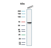 Western blot analysis of human MCF7 cell lysates using recombinant ESR1/Estrogen receptor 1 antibody recombinant mouse mAb rESR1/9525). Predicted molecular weight ~67 kDa.