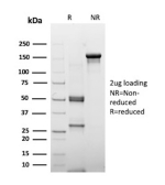 SDS-PAGE Analysis of purified Estrogen receptor 2/ESR2 antibody (clone ESR2/6661). Confirmation of Purity and Integrity of Antibody.