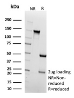 SDS-PAGE Analysis of purified Estrogen receptor beta/ER beta antibody (clone ESR2/9709). Confirmation of Purity and Integrity of Antibody.