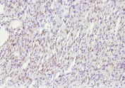 ER beta Antibody Ovary IHC. Immunohistochemistry analysis of Estrogen receptor beta 2 in human ovary tissue. Formalin-fixed, paraffin-embedded human ovary tissue was stained with ER beta/Estrogen receptor beta antibody (clone ESR2/9710), showing nuclear staining in ovarian stromal and follicular-associated cells. Hematoxylin was used as a nuclear counterstain. Staining of formalin-fixed tissues required heating tissue sections in 10mM Tris with 1mM EDTA, pH 9.0, for 45 min at 95oC followed by cooling at room temperature.