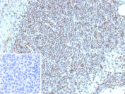 ETS1 Antibody Lymph Node IHC. Immunohistochemistry of FFPE human lymph node tissue using ETS1 antibody shows strong HRP-DAB brown nuclear staining in lymphoid cells, consistent with ETS1 function as a transcriptional regulator in immune cell populations and supporting its role in transcriptional regulation within the lymphoid microenvironment; inset shows a negative control section processed with PBS instead of primary antibody, confirming minimal non-specific staining. Detection was performed with clone r1G11. HIER: heat tissue sections in 10mM Tris with 1mM EDTA, pH 9.0, for 45 min at 95oC followed by cooling at room temperature.