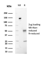 SDS-PAGE Analysis of purified FABP2/Fatty acid binding protein 2 antibody (FABP2/6344). Confirmation of Purity and Integrity of Antibody.