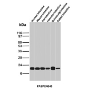 Intestinal FABP Antibody Multi-Species Intestine WB. Western blot analysis of FABP2 in intestinal tissues. Western blot analysis was performed using tissue lysates from human intestine, mouse intestine, rat intestine, hamster intestine, guinea pig intestine, and rabbit intestine probed with Intestinal FABP/Intestinal fatty acid-binding protein antibody (clone FABP2/6345). A distinct immunoreactive band is observed at the predicted molecular weight of FABP2 across all intestinal samples, consistent with conserved expression of Intestinal FABP in absorptive intestinal epithelium. Predicted molecular weight ~15 kDa.