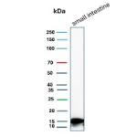 Intestinal FABP Antibody Small Intestine WB. Western blot analysis of human small intestine tissue lysate using Intestinal FABP/Intestinal fatty acid-binding protein antibody (FABP2/6345).